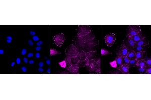 anti-Four and A Half LIM Domains 2 (FHL2) antibody