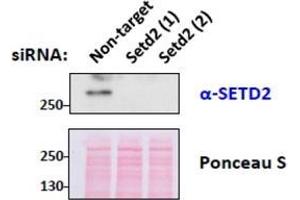 SETD2 Antibody (0. (SETD2 抗体  (Internal Region))