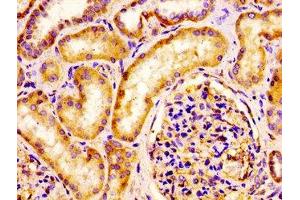 IHC image of ABIN7157026 diluted at 1:100 and staining in paraffin-embedded human kidney tissue performed on a Leica BondTM system. (IQCB1 抗体  (AA 445-598))