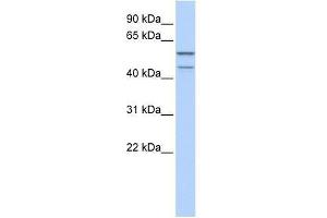 Western Blot showing ZNF474 antibody used at a concentration of 1-2 ug/ml to detect its target protein. (ZNF474 抗体  (N-Term))