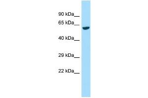 Host:  Rabbit  Target Name:  Galnt2  Sample Type:  Rat Kidney lysates  Antibody Dilution:  1. (GALNT2 抗体  (C-Term))