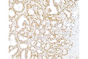 Immunohistochemistry (IHC) image for anti-U2 Small Nuclear RNA Auxiliary Factor 1 (U2AF1) (AA 140-190) antibody (ABIN7453889) (U2AF1 抗体  (AA 140-190))