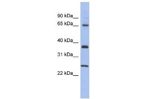 WB Suggested Anti-HORMAD2 Antibody Titration: 0. (HORMAD2 抗体  (Middle Region))