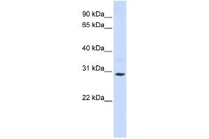 WB Suggested Anti-SLC25A20 Antibody Titration:  0.