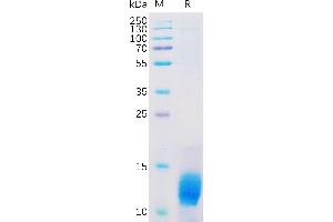 Human Protein, His Tag on SDS-PAGE under reducing condition.