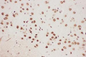 Anti-ALOX5 Picoband antibody,  IHC(P): Mouse Brain Tissue (ALOX5 抗体  (AA 120-483))