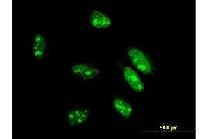 Immunofluorescence of monoclonal antibody to CDX1 on HeLa cell.