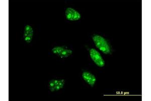 Immunofluorescence of monoclonal antibody to CDX1 on HeLa cell. (CDX1 抗体  (AA 126-215))