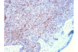 Formalin-fixed, paraffin-embedded human Skin stained with p73 Mouse Monoclonal Antibody (P73/2531).