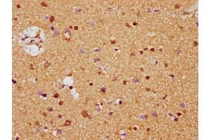 IHC image of ABIN7158941 diluted at 1:400 and staining in paraffin-embedded human brain tissue performed on a Leica BondTM system. (MDH1 抗体  (AA 1-334))