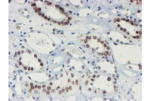 Image no. 6 for anti-SUMO1/sentrin/SMT3 Specific Peptidase 2 (SENP2) (AA 139-523) antibody (ABIN1490926)