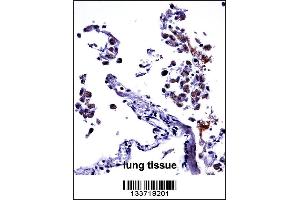 IL13 Antibody immunohistochemistry analysis in formalin fixed and paraffin embedded human lung tissue followed by peroxidase conjugation of the secondary antibody and DAB staining.