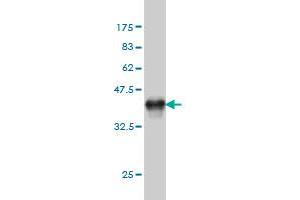 Western Blotting (WB) image for anti-Proteasome (Prosome, Macropain) 26S Subunit, Non-ATPase, 5 (PSMD5) (AA 405-504) antibody (ABIN562492)