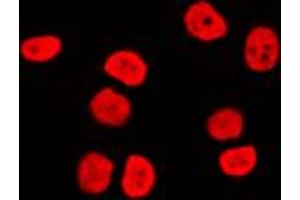 Immunofluorescent analysis of BAF170 staining in Raji cells. (SMARCC2 抗体  (Center))