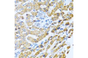Immunohistochemistry of paraffin-embedded human liver using PROK2 antibody at dilution of 1:100 (40x lens). (PROK2 抗体)