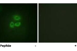 Immunofluorescence analysis of A-549 cells, using PRKD1 polyclonal antibody . (PKC mu 抗体  (Ser205))