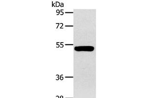 Western Blot analysis of Human fetal muscle tissue using GJA9 Polyclonal Antibody at dilution of 1:400 (GJA9 抗体)
