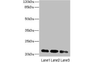 Western blot All lanes: MRPL11 antibody at 16 μg/mL Lane 1: HepG2 whole cell lysate Lane 2: Hela whole cell lysate Lane 3: A549 whole cell lysate Secondary Goat polyclonal to rabbit IgG at 1/10000 dilution Predicted band size: 21, 19, 20 kDa Observed band size: 21 kDa (MRPL11 抗体  (AA 1-191))
