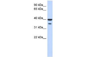 WB Suggested Anti-ZNF785 Antibody Titration:  0. (ZNF785 抗体  (N-Term))