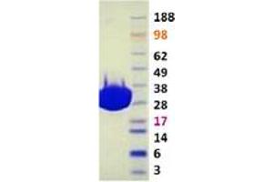 Validation with Western Blot (PAK6 Protein (Transcript Variant 1))