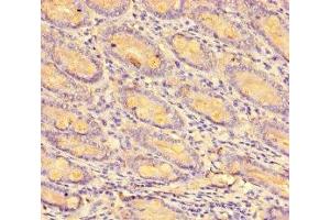 Immunohistochemistry of paraffin-embedded human small intestine tissue using ABIN7146019 at dilution of 1:100 (CCL8 抗体  (AA 24-99))