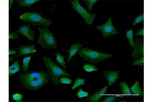 Immunofluorescence (IF) image for anti-Integrin, alpha X (Complement Component 3 Receptor 4 Subunit) (ITGAX) (AA 1-1169) antibody (ABIN948047)