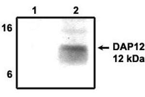 Immunoprecipitation using DAP12  antibody on MHC class I (1) and  NKp44 (2) positive cells. (TYROBP 抗体  (Cytoplasmic Domain))