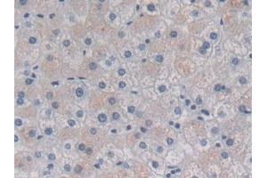 Immunohistochemistry (IHC) image for anti-Heat Shock 27kDa Protein Family, Member 7 (Cardiovascular) (HSPB7) (AA 1-170) antibody (ABIN7441055)