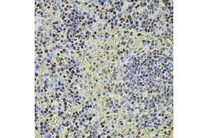 Immunohistochemistry of paraffin-embedded mouse spleen using POT1 antibody (ABIN5970699) at dilution of 1/100 (40x lens). (POT1 抗体)