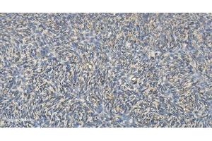 IHC analysis of FLCN using anti-FLCN antibody (ABIN7602491). (FLCN 抗体  (AA 8-551))