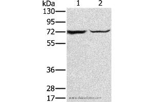 Western blot analysis of Mouse liver tissue and hepg2 cell, using SLC25A13 Polyclonal Antibody at dilution of 1:450 (slc25a13 抗体)