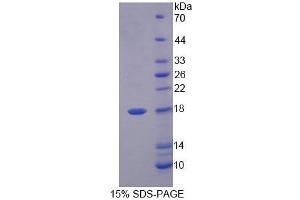 SDS-PAGE analysis of Pig FABP6 Protein. (FABP6 蛋白)