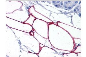 Human Adipocytes: Formalin-Fixed, Paraffin-Embedded (FFPE) (PLIN4 抗体  (Internal Region))