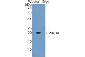 Western Blotting (WB) image for anti-Tumor Necrosis Factor (Ligand) Superfamily, Member 13 (TNFSF13) (AA 93-250) antibody (ABIN2904388)