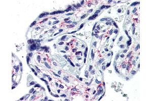 Anti-IL1R1 antibody IHC of human placenta. (IL1R1 抗体  (Extracellular Domain))