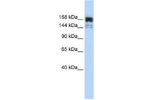 XRN1 antibody used at 1 ug/ml to detect target protein. (XRN1 抗体  (Middle Region))