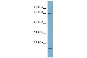 Plastin 3 antibody used at 1 ug/ml to detect target protein. (Plastin 3 抗体)
