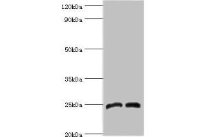 Western blot All lanes: Dickkopf-related protein 4 antibody at 8 μg/mL Lane 1: Jurkat whole cell lysate Lane 2: K562 whole cell lysate Secondary Goat polyclonal to rabbit IgG at 1/10000 dilution Predicted band size: 25 kDa Observed band size: 25 kDa (DKK4 抗体  (AA 19-224))