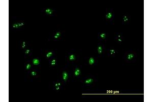 Immunofluorescence of purified MaxPab antibody to DDX18 on HeLa cell. (DDX18 抗体  (AA 1-670))