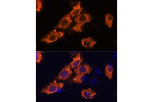 Immunofluorescence analysis of C6 cells using SEMA antibody (ABIN7270199) at dilution of 1:100. (Sema4a 抗体  (AA 320-580))
