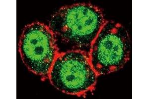 Confocal immunofluorescent analysis of PAK1 antibody with HeLa cells followed by Alexa Fluor 488-conjugated goat anti-rabbit lgG (green). (PAK1 抗体  (AA 401-430))