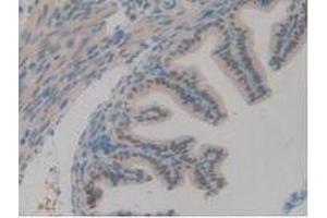 IHC-P analysis of Mouse Ovary Tissue, with DAB staining. (TICAM1 抗体  (AA 263-526))