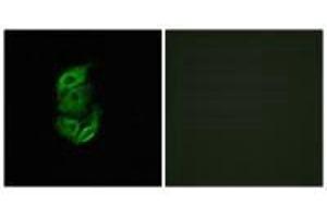 Immunofluorescence analysis of A549 cells, using STA13 antibody. (STARD13 抗体  (N-Term))