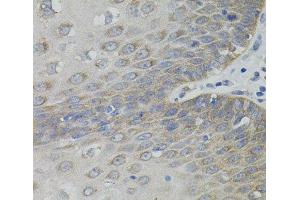 Immunohistochemistry of paraffin-embedded Human esophagus using SLC30A1 Polyclonal Antibody (SLC30A1 抗体)