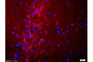 Formalin-fixed and paraffin-embedded rat brain labeled with Anti ADCY10 Polyclonal Antibody, Unconjugated (ABIN751093) 1:200, overnight at 4°C, The secondary antibody was Goat Anti-Rabbit IgG, Cy3 conjugated used at 1:200 dilution for 40 minutes at 37°C. (ADCY10 抗体  (AA 1101-1200))