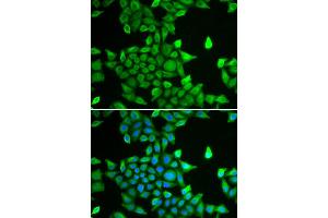 Immunofluorescence analysis of MCF-7 cell using PSMA6 antibody. (PSMA6 抗体  (AA 1-246))