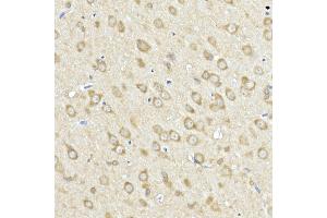 Immunohistochemistry (IHC) image for anti-Acyl-CoA Synthetase Long-Chain Family Member 4 (ACSL4) (AA 1-280) antibody (ABIN6136458)