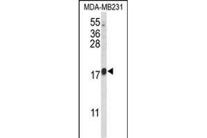 Western blot analysis of HRIHF Antibody (C-term) (ABIN653093 and ABIN2842686) in MDA-M cell line lysates (35 μg/lane). (CBY1/PGEA1 抗体  (C-Term))