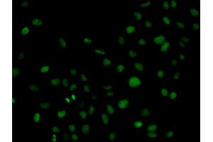 Immunofluorescence analysis of HeLa cells using PLCG2 antibody (ABIN5971208). (Phospholipase C gamma 2 抗体)