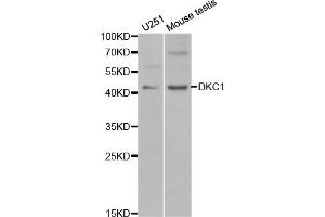 Western blot analysis of extracts of various cell lines, using DKC1 antibody (ABIN5970956) at 1/1000 dilution. (DKC1 抗体)